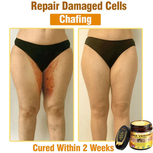 🔥FDA Approved: Bee Venom Skin Restoration Cream — 🔥Limited Time 80% OFF🔥